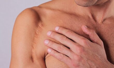 ❝ Las heridas no curan el mismo mito o verdad de la Semana Santa