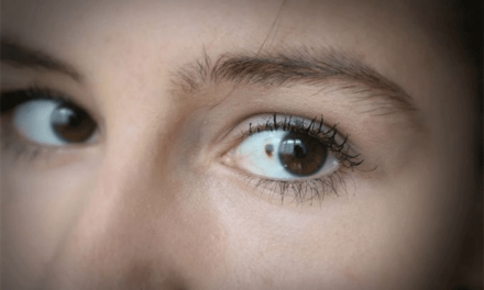 Los investigadores crean avatares tumorales que prueban nuevos tratamientos contra el cáncer de ojo