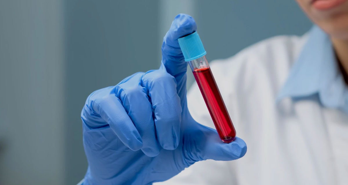 USA aprueba el uso no publicado de examen de casta para Alzheimer creado por el camarilla japonés