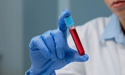 USA aprueba el uso no publicado de examen de casta para Alzheimer creado por el camarilla japonés