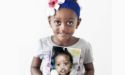 Operation Smile Dominican Republic Foundation mantendrá quirúrgico de labios y paladares gruesos libres