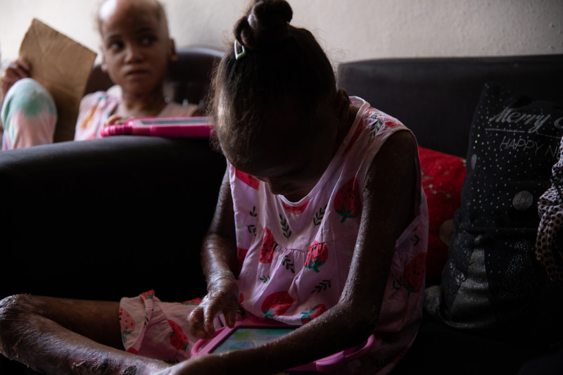 «B» Sangre positiva necesaria urgentemente para una pupila que padece una enfermedad rara