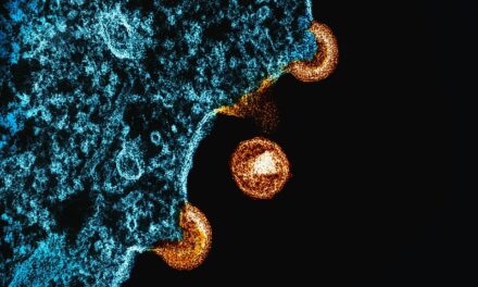 Costos de tratamiento del VIH Estado dominicano US $ 14.4 millones