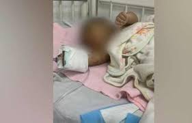 El bebé de tres meses supuestamente atacado por su principio ya está bajo el cuidado de su padre