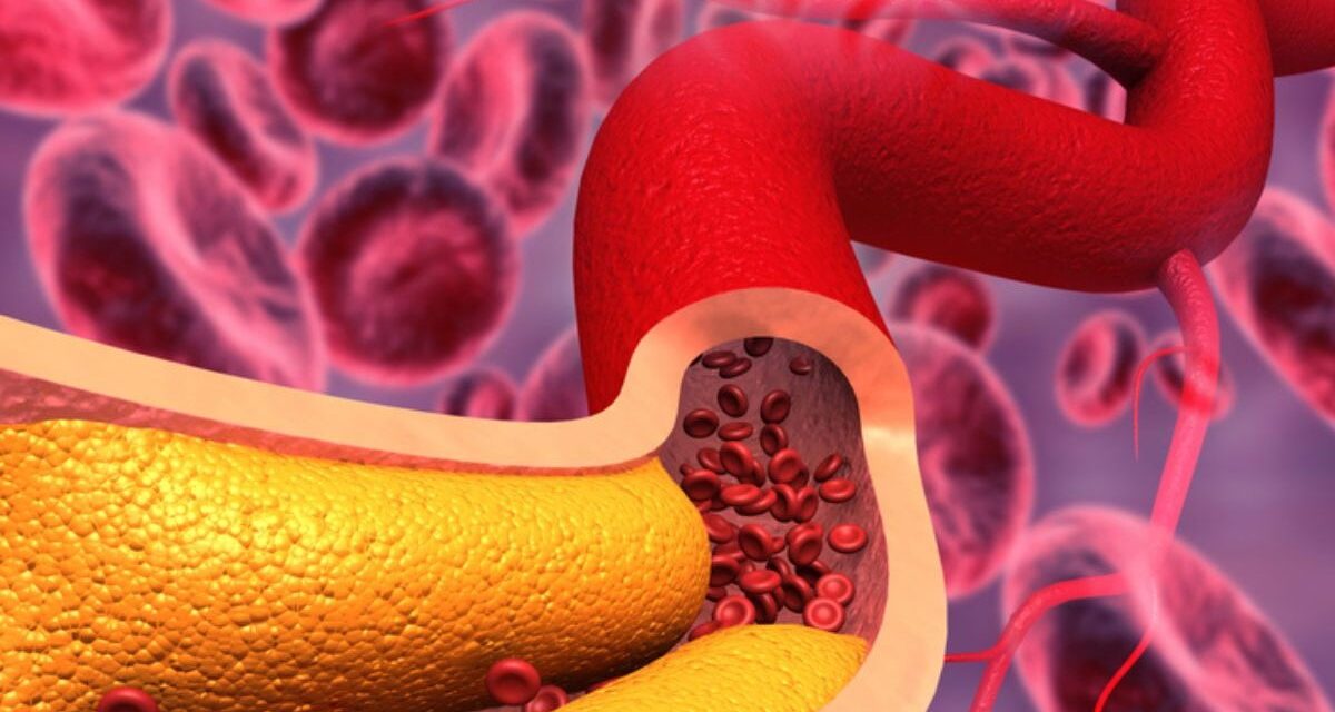 36.5% de la población adulta dominicana presenta colesterol total parada