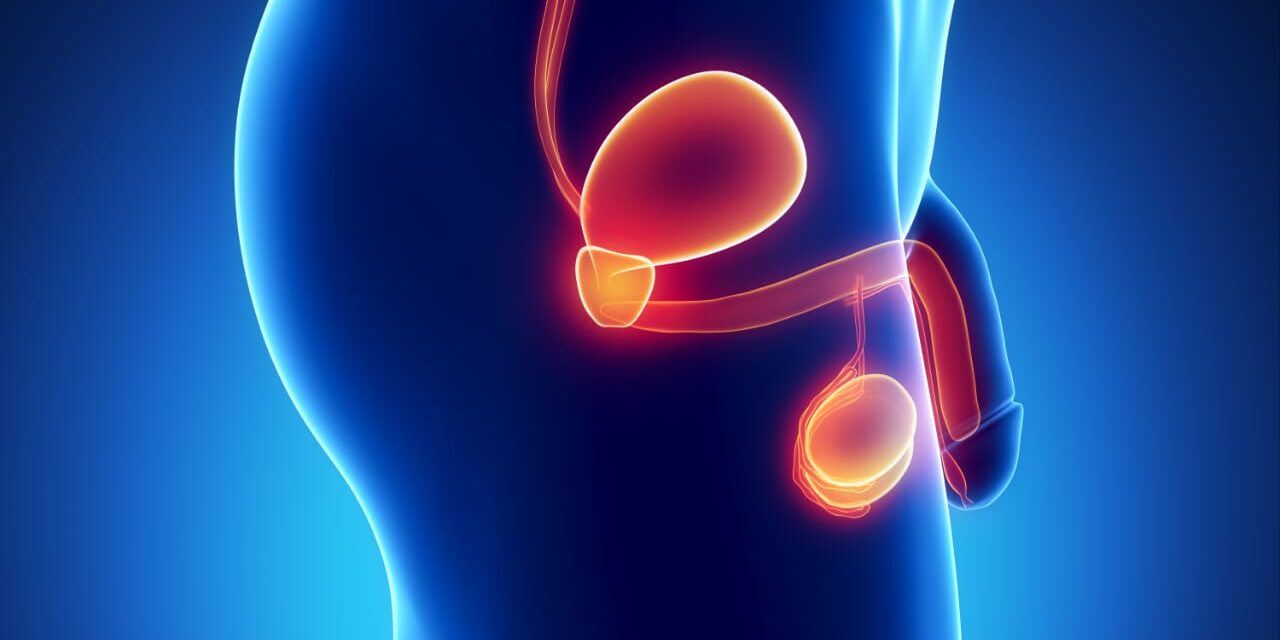 Romper mitos: el cáncer de próstata no es solo una enfermedad de los hombres mayores