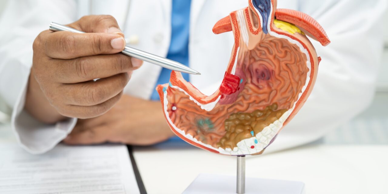 Prevenir el cáncer de páncreas es posible con hábitos saludables