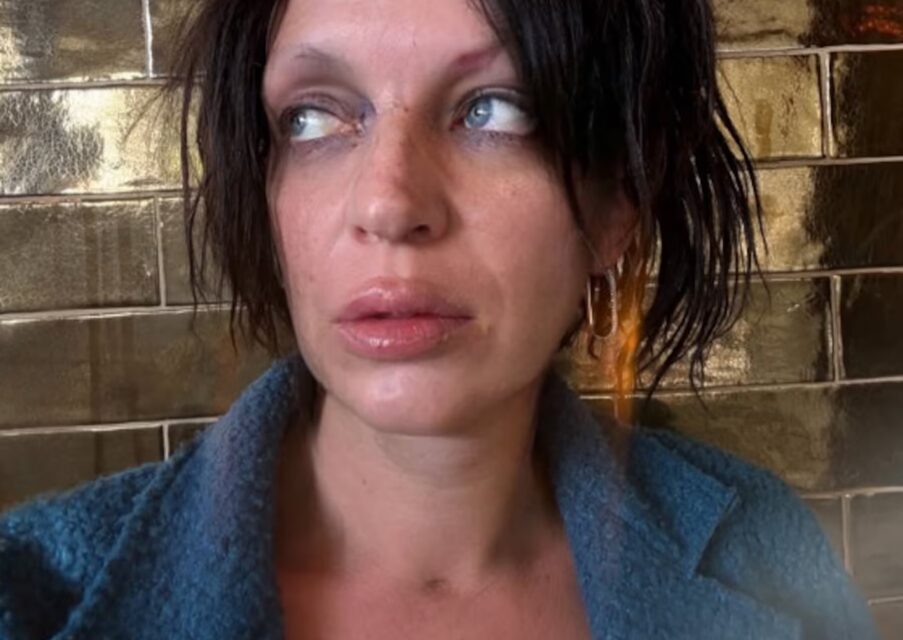 El hijo de Camilo Sesto ingresa en el hospital