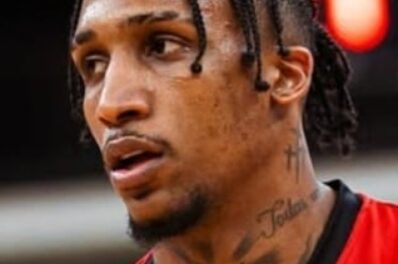 Jassel se recupera de un cuadro de aversión